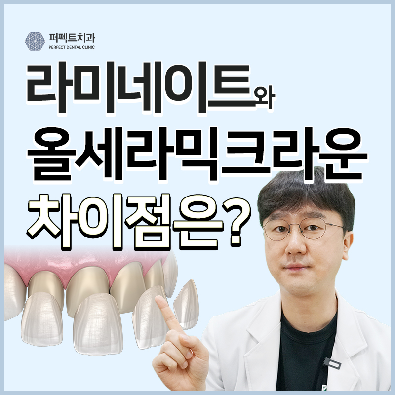 라미네이트와 올세라믹 차이점은? 관련 이미지 1