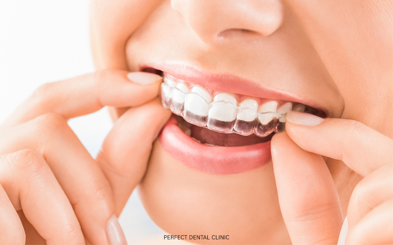 보이지 않는 투명교정 인비절라인 관련 이미지 1