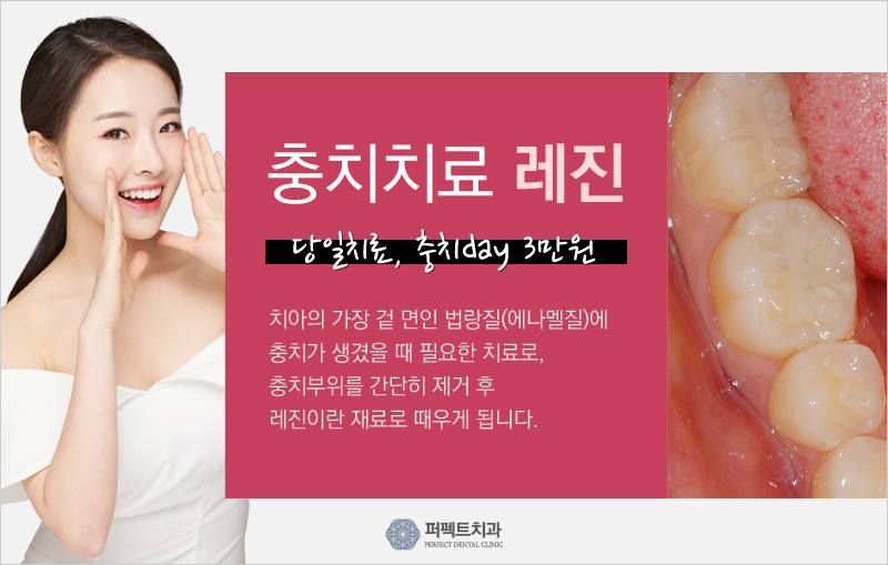 부담없는 충치치료가격 충치DAY로~&hearts; 관련 이미지 5