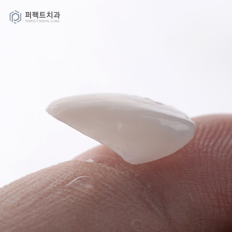 탈락한 라미네이트 재부착 가능할까요? 관련 이미지 4