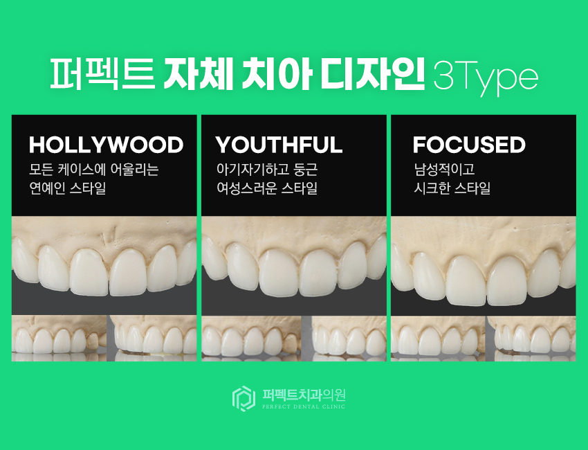 라미네이트 치료 시 참고사항은? 관련 이미지 6