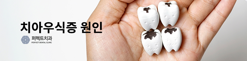 치아우식증 원인과 예방법 관련 이미지 2