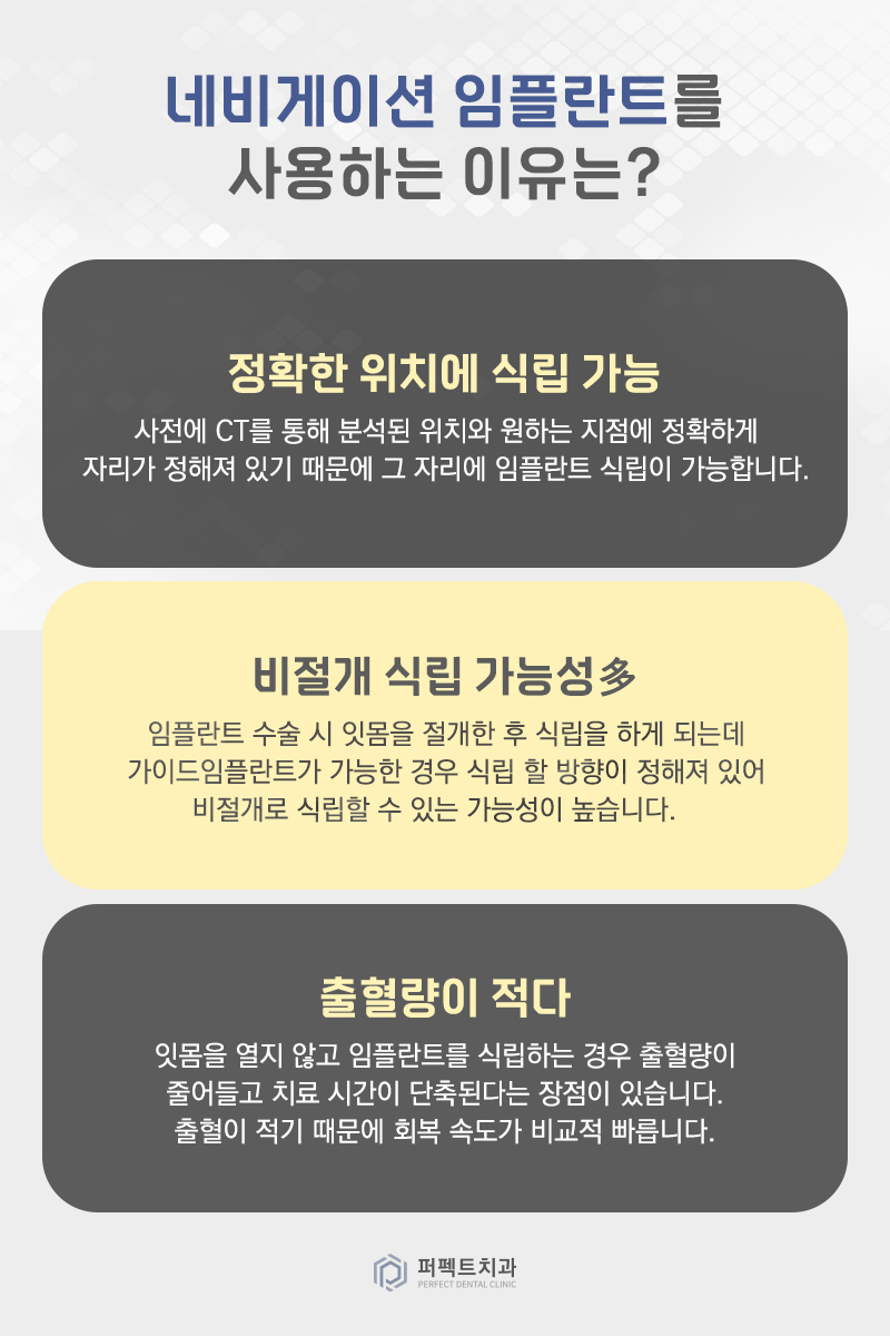 네비게이션 임플란트? 일반 임플란트랑 뭐가 달라?! 관련 이미지 3