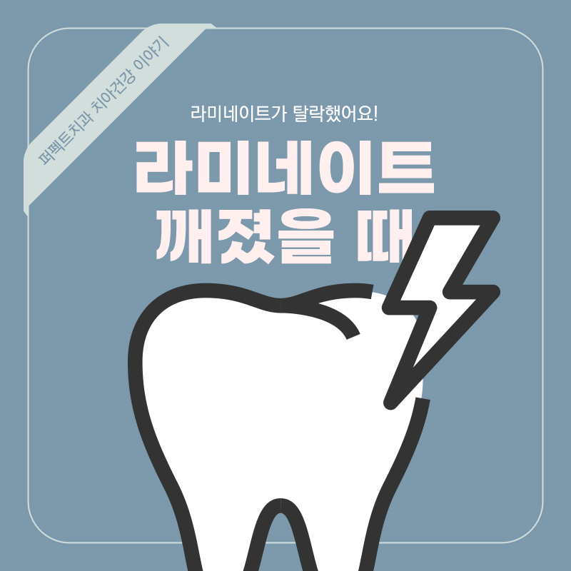 라미네이트 탈락(빠지거나 깨졌을때) 어떻게 해야되나요? 관련 이미지 1