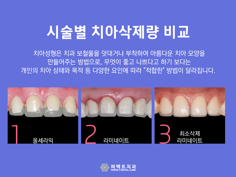 토끼이빨라미네이트 알아보고 있다면?! 관련 이미지 2