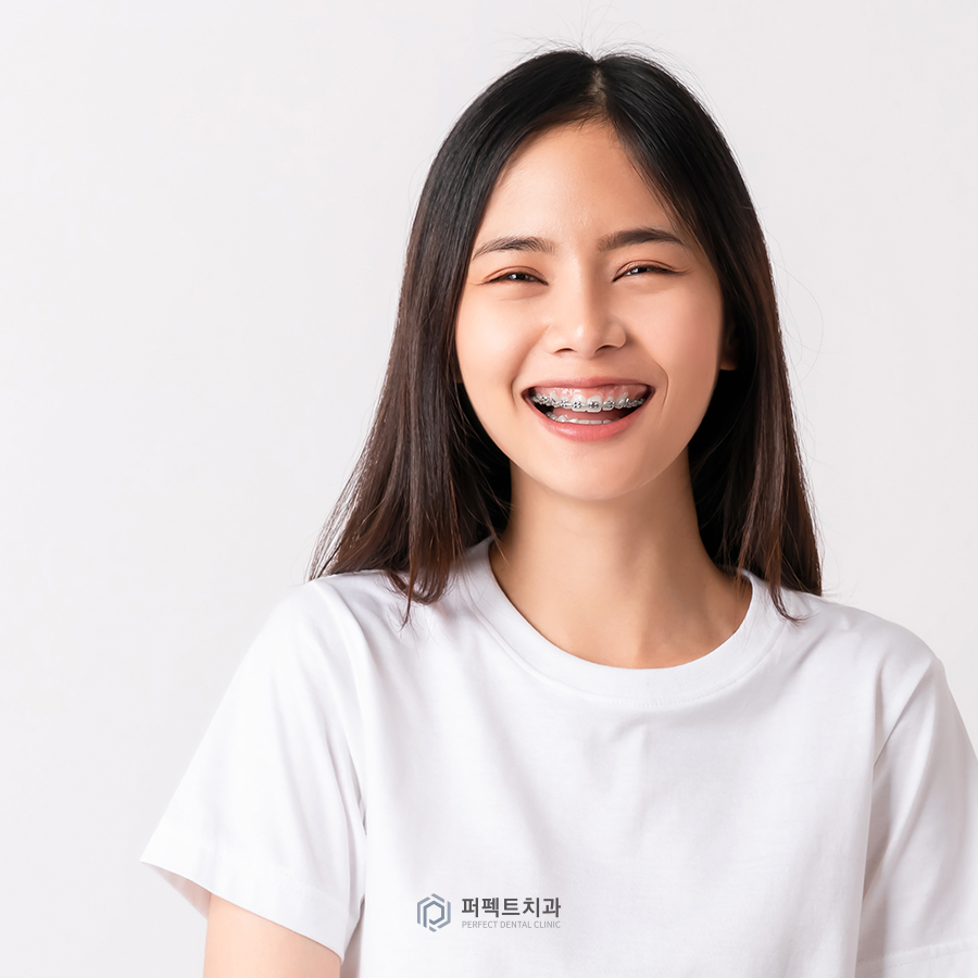 치아교정을 하기 좋은 최적의 시기는? 관련 이미지 3