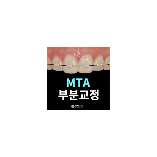 MTA부분교정으로 단기간 교정끝내기 관련 이미지 7