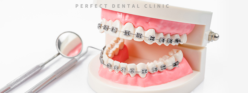 강남역치과 치아부분교정 비용 관련 이미지 2