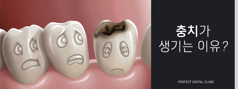 충치치료 비용 얼마인가요? 관련 이미지 2