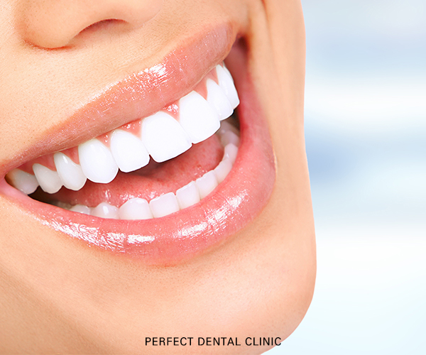 앞니 라미네이트 하기 전, 체크사항! 관련 이미지 2