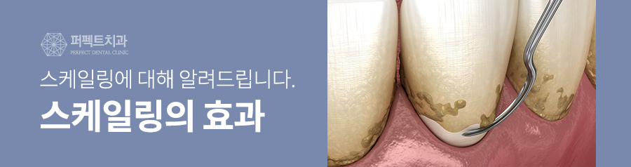 스케일링 아직 안받은 사람? 연 1회 건강보험 적용! 관련 이미지 3