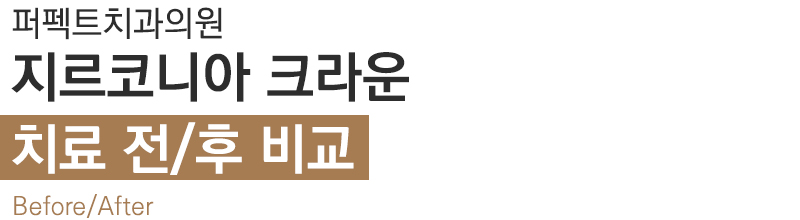 선릉역 치과 추천 확인해보세요! 관련 이미지 2
