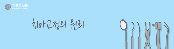 치아교정 월체크, 안 간지 오래되었어요 관련 이미지 2