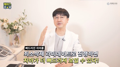 반대교합, 뻐드러진 치아 라미네이트 가능?! 관련 이미지 4