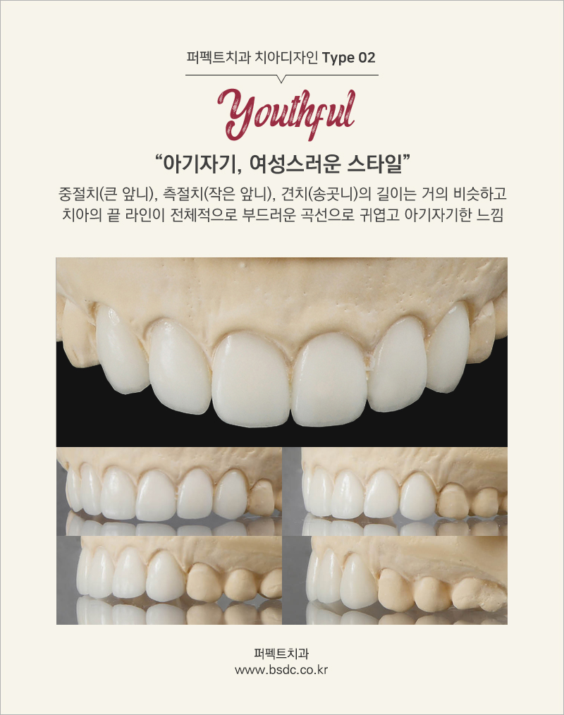 강남 최소삭제라미네이트 알아주는 치과 관련 이미지 9