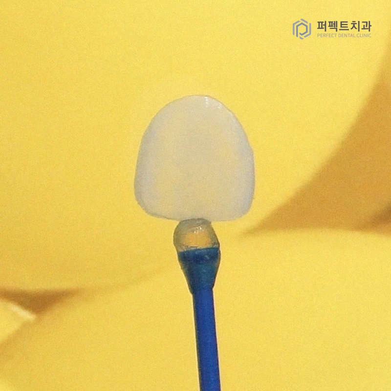 라미네이트는 무조건 얇을 게 좋을까? 관련 이미지 4