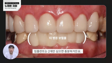 노화된 치아, 최소삭제라미네이트 관련 이미지 4