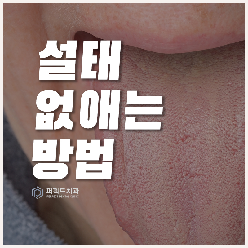 설태 생기는 이유와 없애는 방법 관련 이미지 1