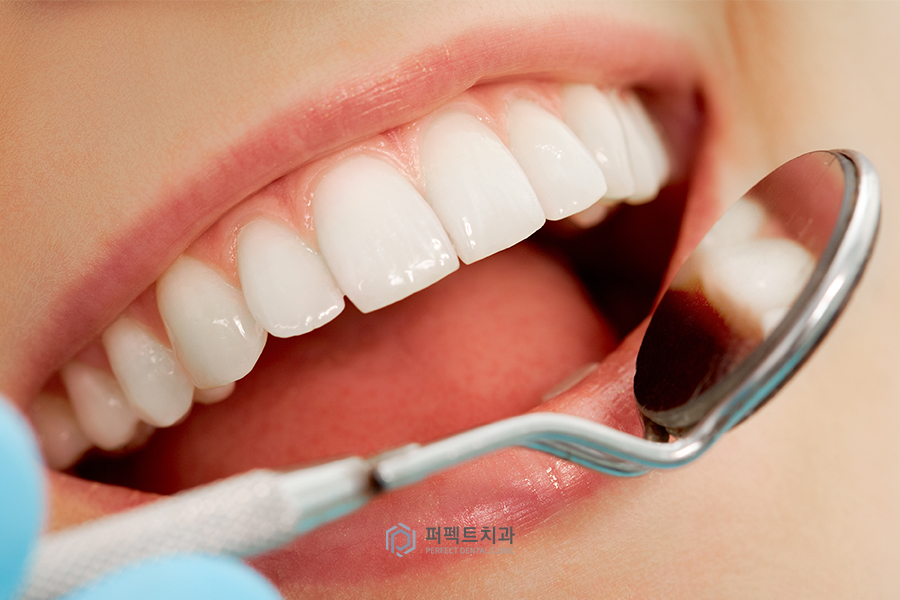 치아도 부식될 수 있다? 치아부식의 원인은? 관련 이미지 1