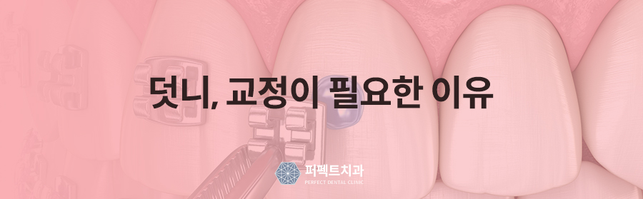 덧니교정,발치 꼭 해야되나요? 관련 이미지 3