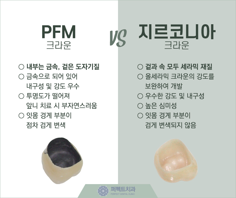 지르코니아크라운 저렴하게 할 수 있어! 관련 이미지 7