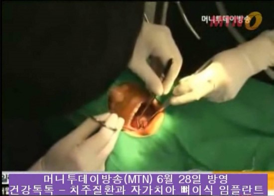 MTN 건강톡톡 방송장면^^ 관련 이미지 9