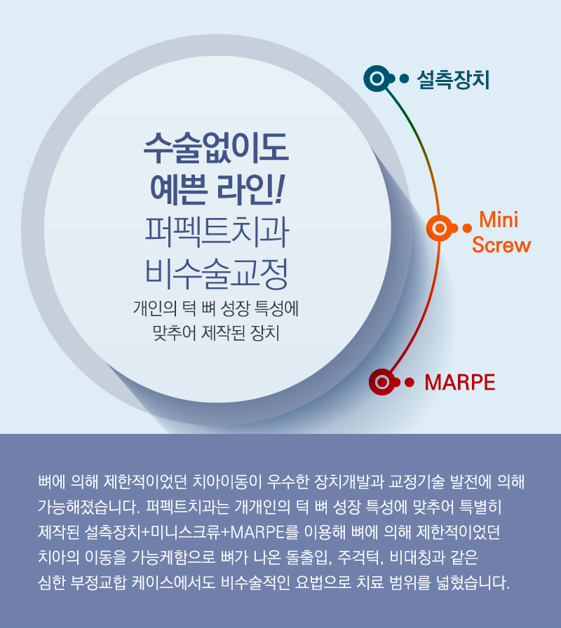 3개월 단기교정으로 빠르게! 관련 이미지 6