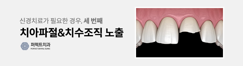 치과 신경치료 통증 관련 이미지 4