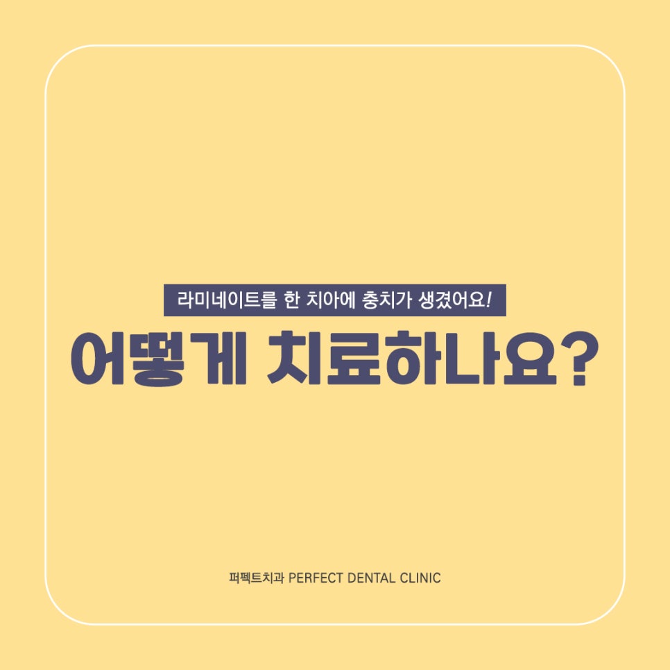 라미네이트 한 치아도 충치가 생길 수 있나요? 관련 이미지 3