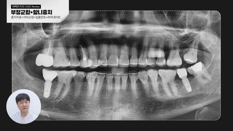 복합적인 치료가 필요한 케이스 리뷰 관련 이미지 7