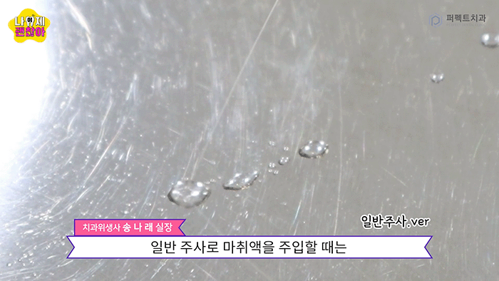 치과마취②｜일반마취vs무통마취, 치과 수면치료 관련 이미지 2