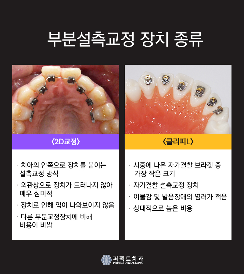 콤비교정에 대해 궁금해요 관련 이미지 2