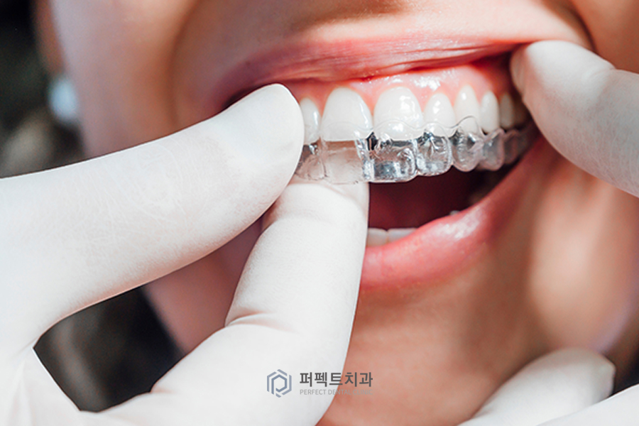 내가 끼고 싶을 때만 끼는 거 아니였어? - 인비절라인에 대한 오해 BEST3 관련 이미지 1