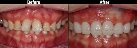 ETN연예채널 "Feeling Up방송출현" 관련 이미지 2