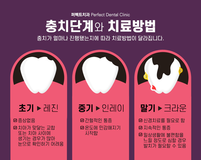 지르코니아 크라운 저렴하게 관련 이미지 5