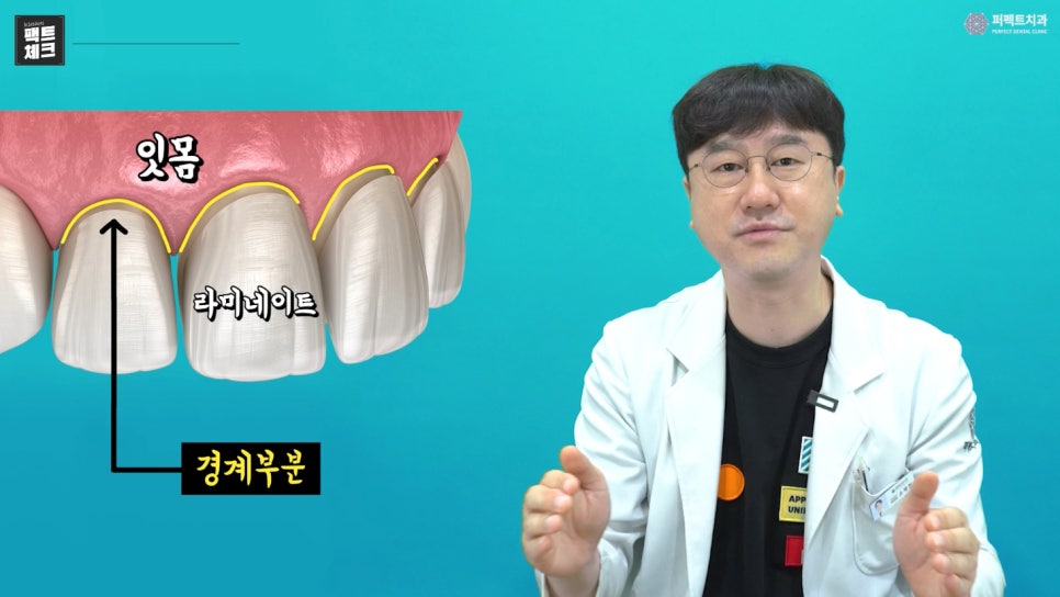 라미네이트 후 치아 관리 어떻게 할까요? 관련 이미지 3