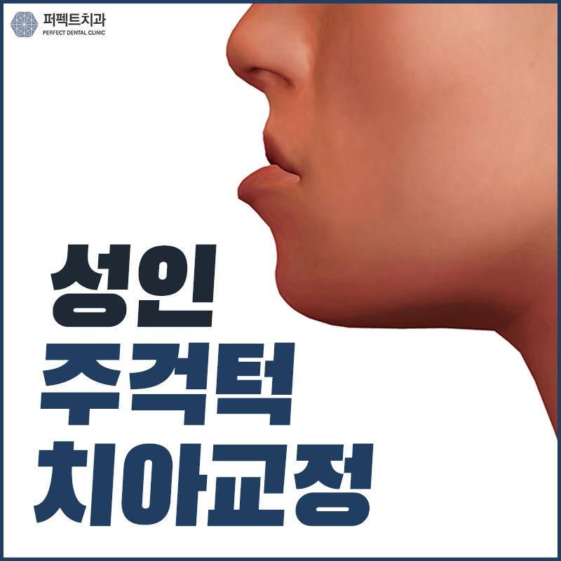 성인주걱턱교정 수술없이 해결! 관련 이미지 1