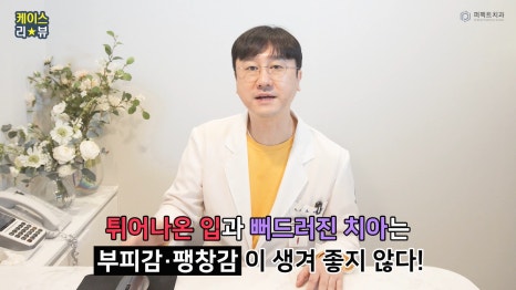 앞니 사이 충치, 최소삭제 라미네이트로! 관련 이미지 3