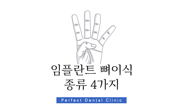 강남 임플란트 뼈이식 잘하는 곳 관련 이미지 3