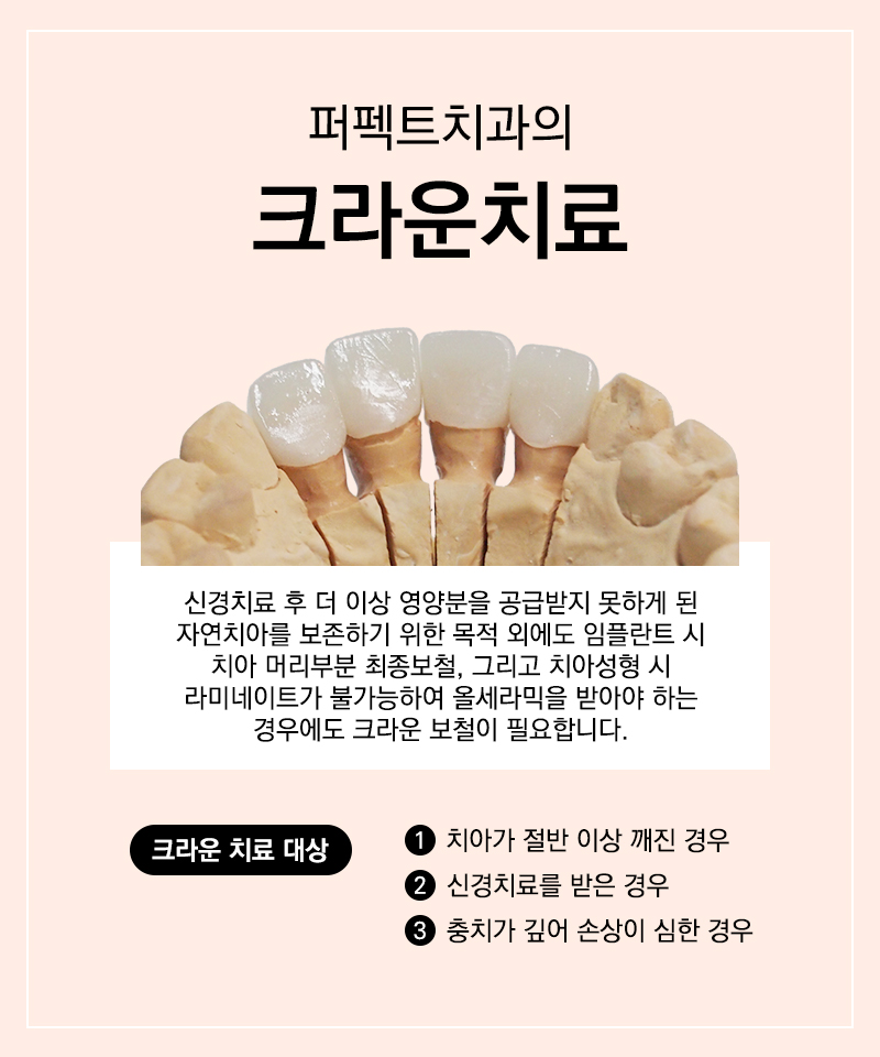 충치치료 치아크라운비용 관련 이미지 5