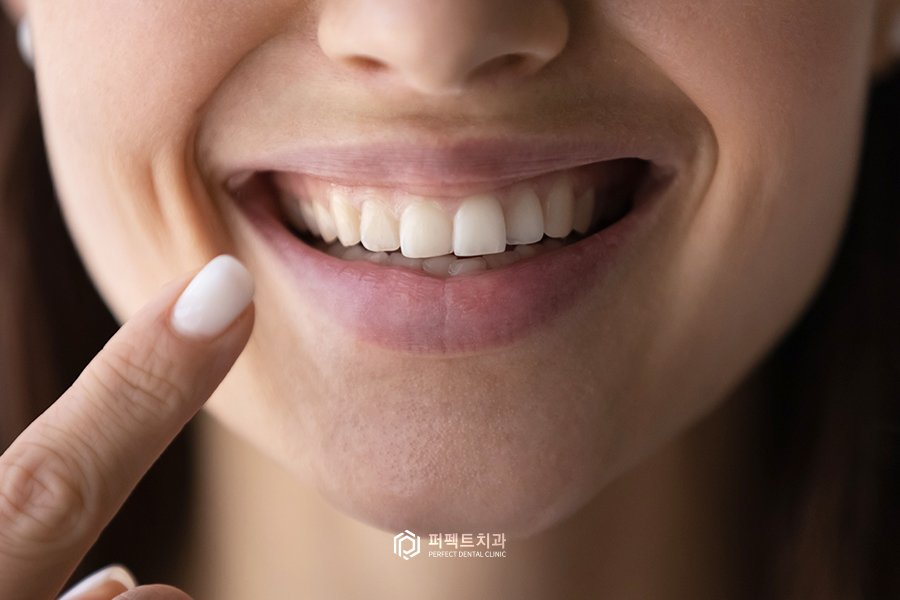 예뻐보이는 치아길이, 비율이 있다? 관련 이미지 1