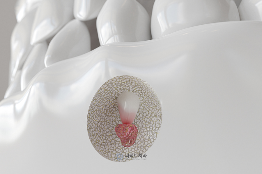 ✨신경치료 질문 BEST③ 관련 이미지 1