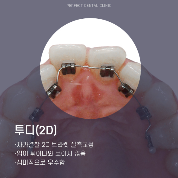 부분교정 찾는 사람들은 주목! 관련 이미지 6