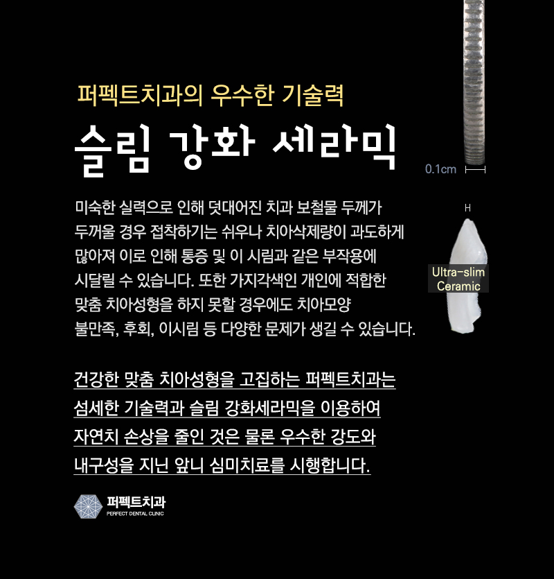 앞니 라미네이트 관련 이미지 10