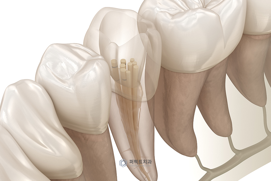 ✨신경치료 질문 BEST③ 관련 이미지 3