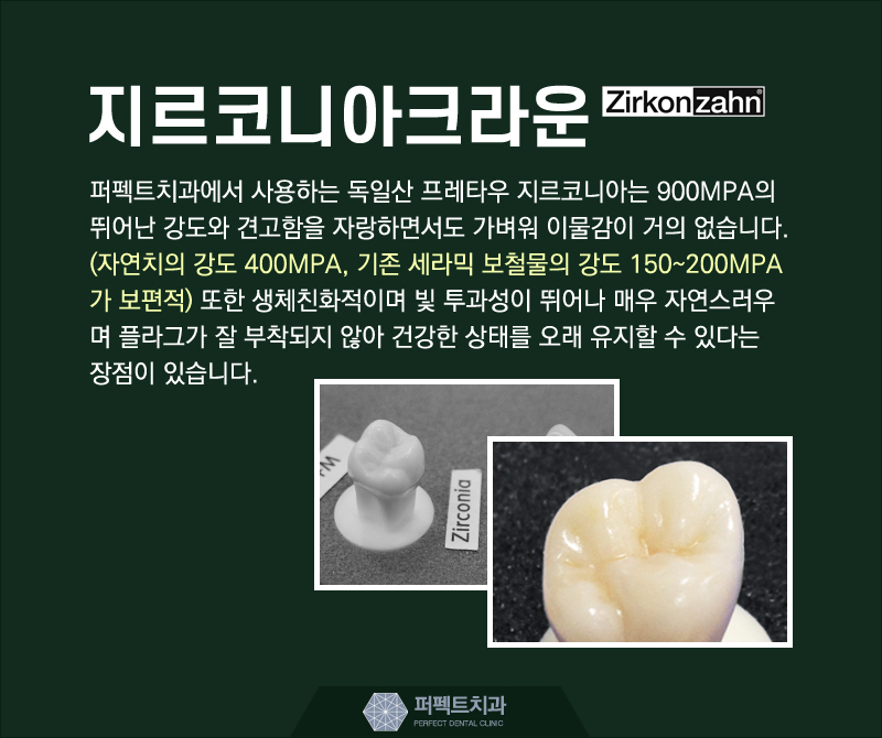 지르코니아크라운 저렴하게 할 수 있어! 관련 이미지 6