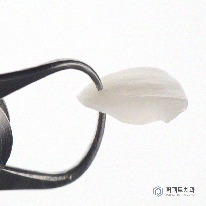 무삭제라미네이트의 솔.직.한 장단점! 관련 이미지 2