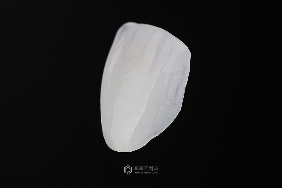 특별한 라미네이트가 있을까? 관련 이미지 1