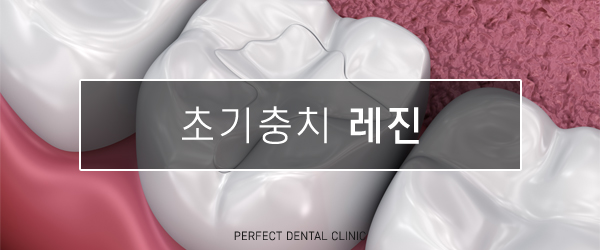 충치치료 비용 얼마인가요? 관련 이미지 4