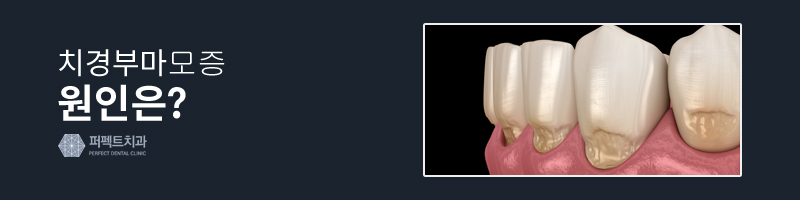 치경부마모증 원인과 치료방법! 관련 이미지 3